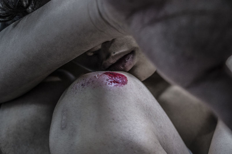 Close-up of man with wound on knee
