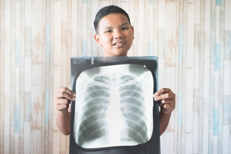 Young teen holding his x-ray film. concept of health care