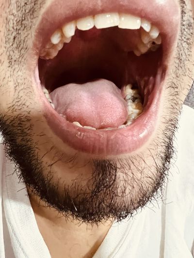 nose
