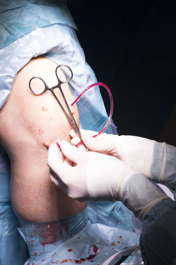 Cropped hands of surgeon doing knee surgery in hospital