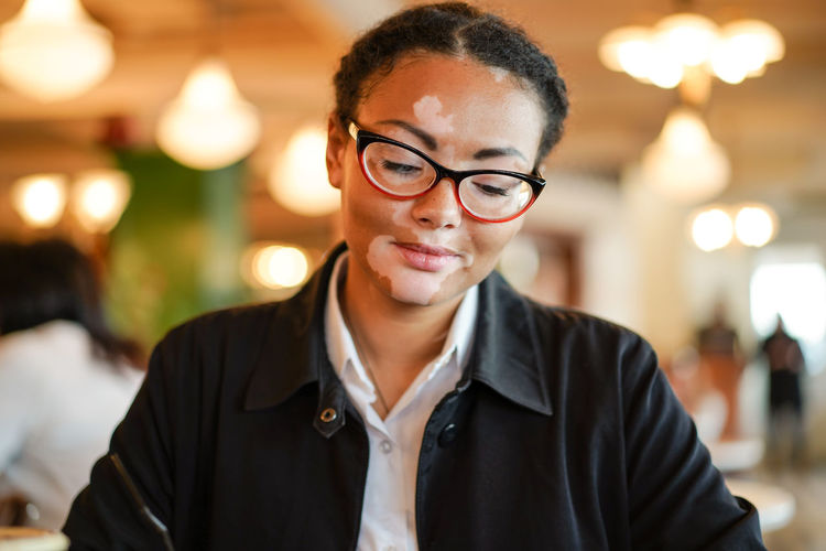 Close-up of young woman with vitiligo sitting in restaurant