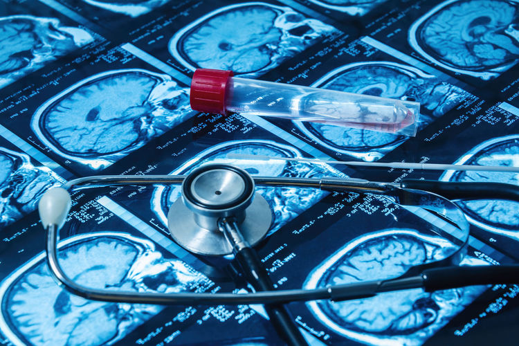 Magnetic resonance fund together with a pcr coronavirus test and a stethoscope selective approach.