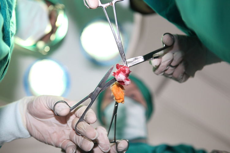 Directly below shot of surgeons holding cotton swab in operating theater