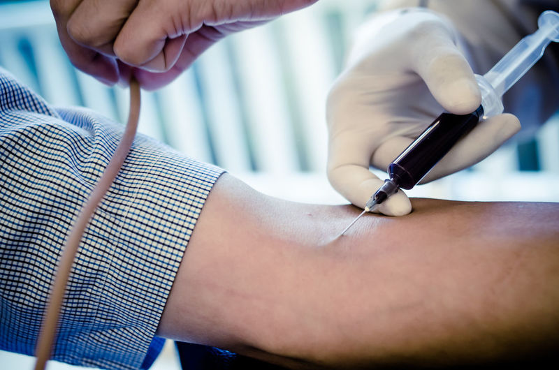 Cropped hand of doctor taking blood samples from patient arm