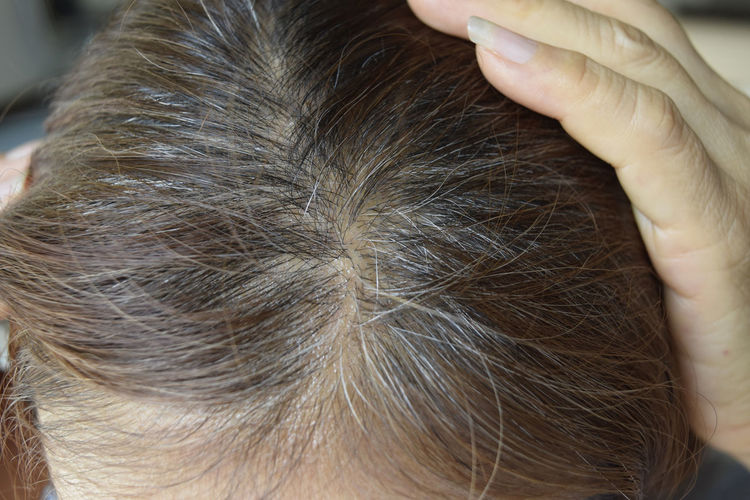 High angle view of woman showing scalp