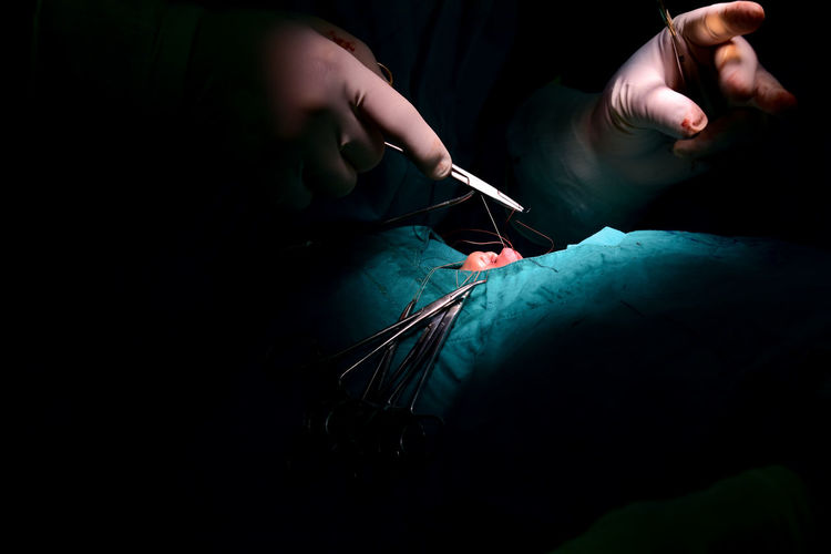 Cropped hands of surgeon stitching patient in operating room