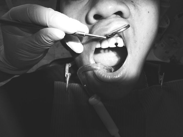 Cropped hand of dentist operating patient teeth in clinic