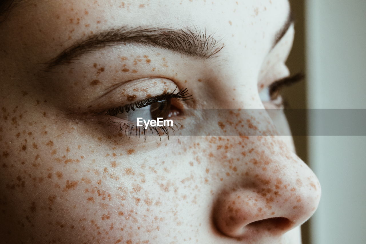 Close-up of thoughtful woman with freckles on face