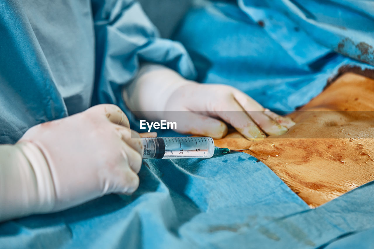 Midsection of surgeons in operating room
