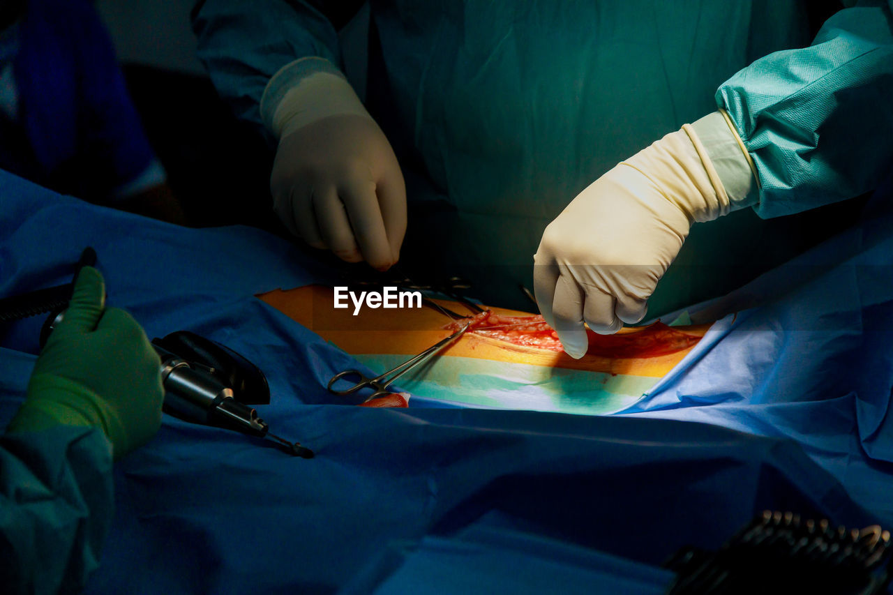 Midsection of surgeon operating patient at operating room
