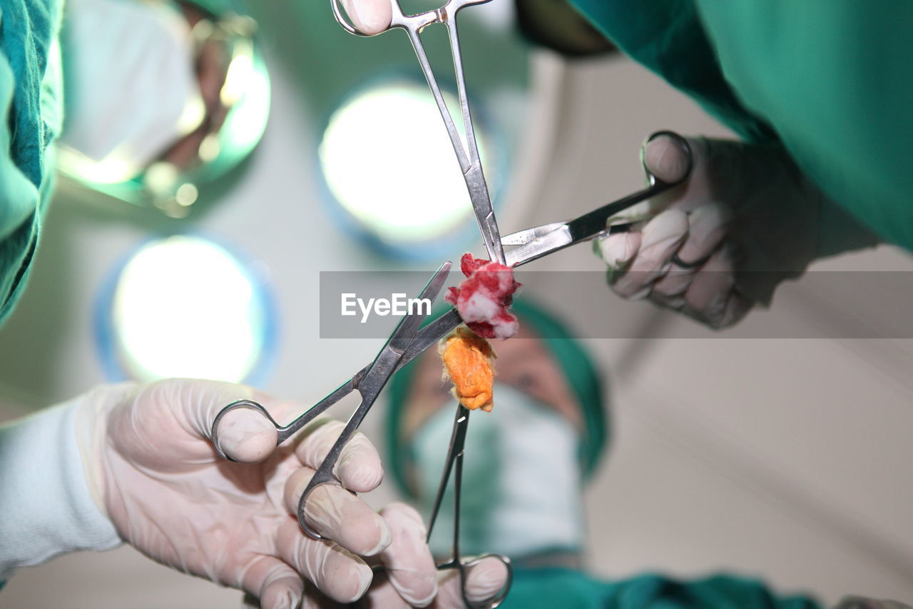 Directly below shot of surgeons holding cotton swab in operating theater