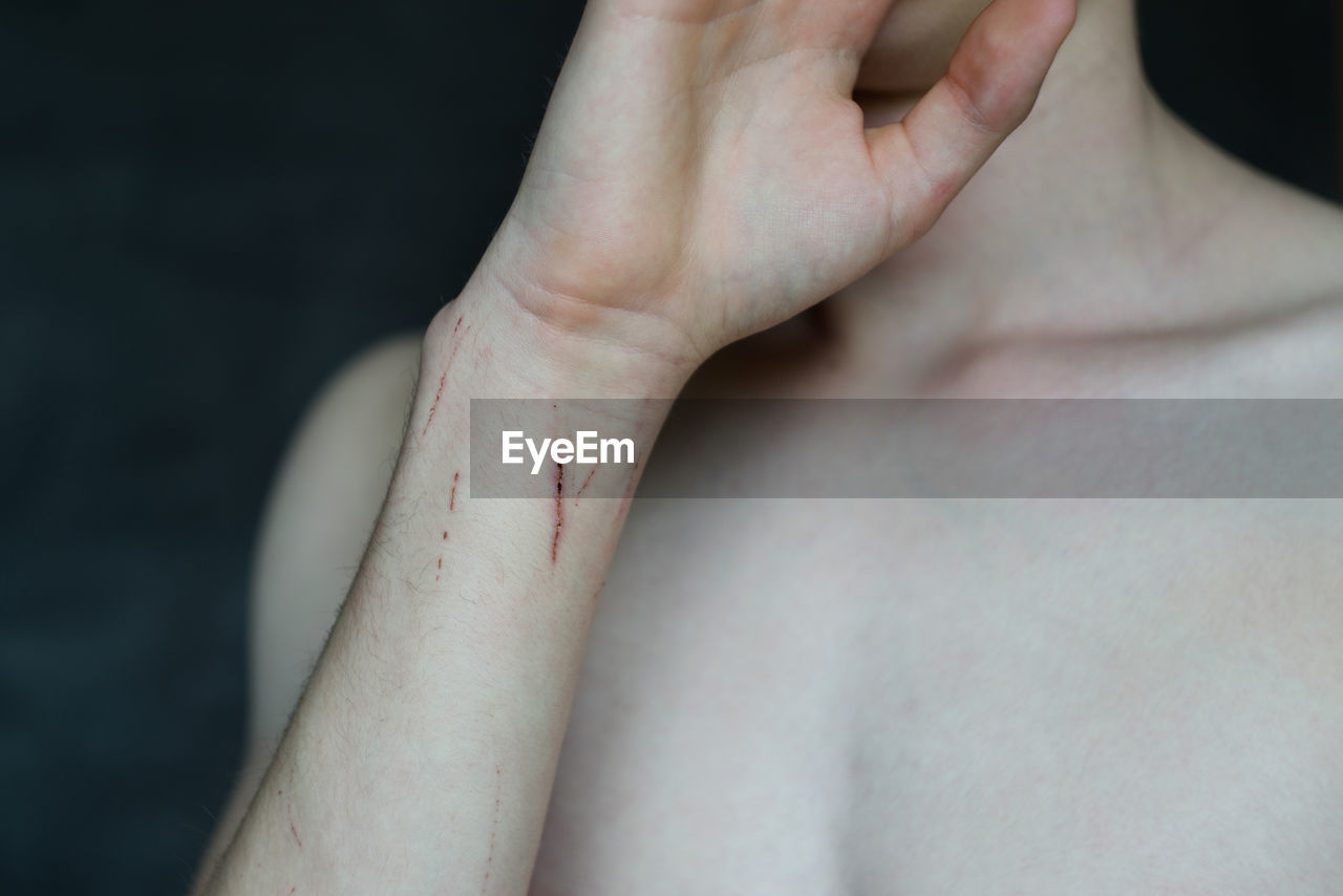 Midsection of shirtless mid adult man with wounded hand against black background