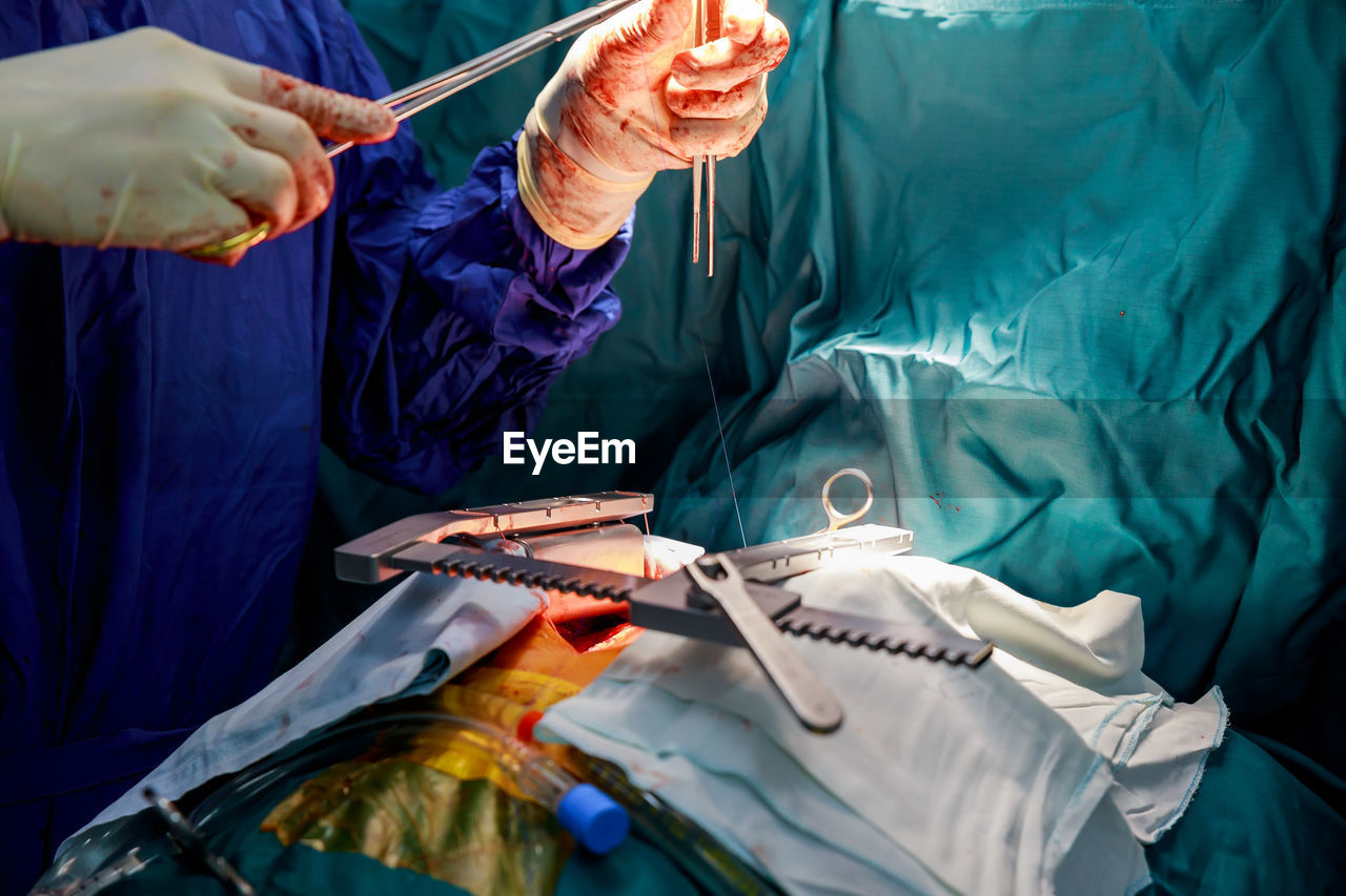 Midsection of doctor doing surgery of patient