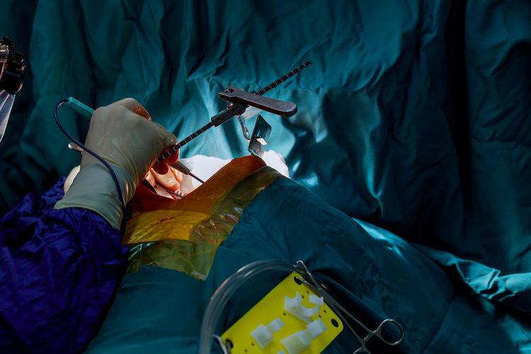 Cropped doctor treating patient in operating room