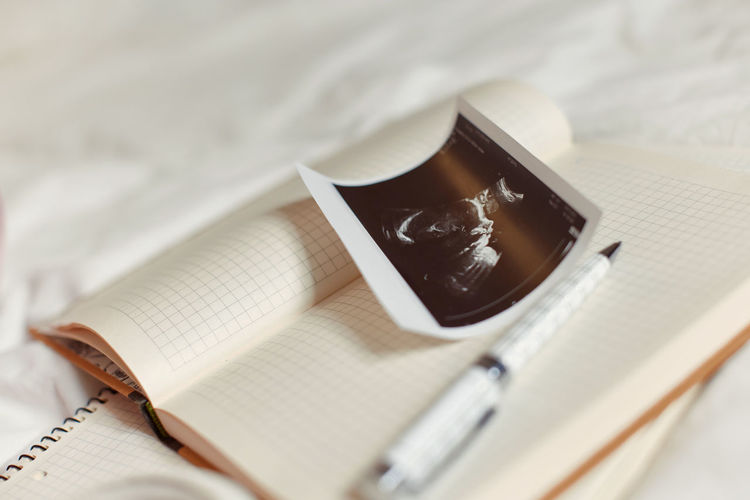 Ultrasound scan result on diary